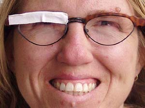 Brille kaputt